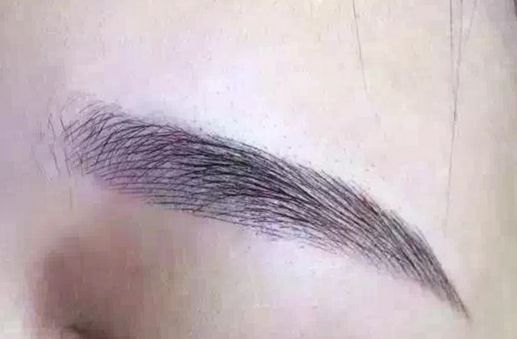 長沙脂肪吸取專家揭秘：技術(shù)卓越，無數(shù)口碑背后的醫(yī)美奇跡！