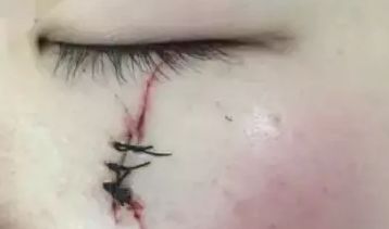 南京智美顏：了解2023吸脂案例曝光，發(fā)現(xiàn)醫(yī)療美容的驚人效果！