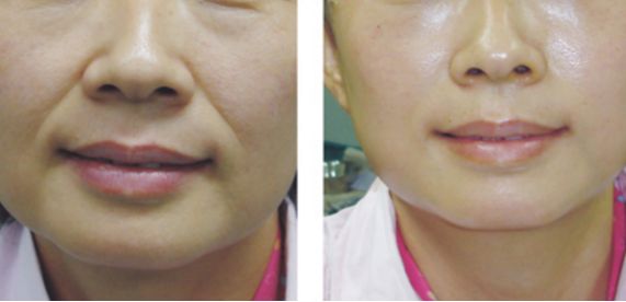 青海紅十字醫(yī)院美容整形科頂級專家盛世名錄，主任醫(yī)生公開曝光！