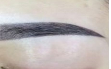 南京植發(fā)綜合醫(yī)院排名高的值得關(guān)注！