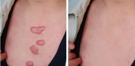 長(zhǎng)春銘醫(yī)整形上榜！雙眼皮醫(yī)生大咖集結(jié)，引爆市場(chǎng)！