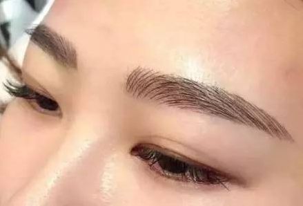 印正山醫(yī)療美容醫(yī)生技術(shù)解析：專業(yè)實(shí)力深受認(rèn)可