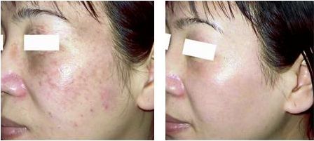 醫(yī)生付德剛面雕案例揭露！技術(shù)如何？詳細(xì)信息公布，附醫(yī)院詳解！