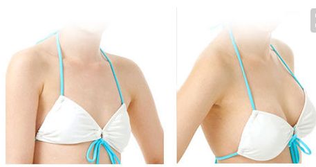 金長鑫哪種技術祛眼袋效果更佳？眼袋手術最新案例解析！