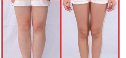 昆山人民醫(yī)院美容科提供哪些整形項目？著名醫(yī)師坐診+讓您雙眼煥發(fā)迷人魅力！