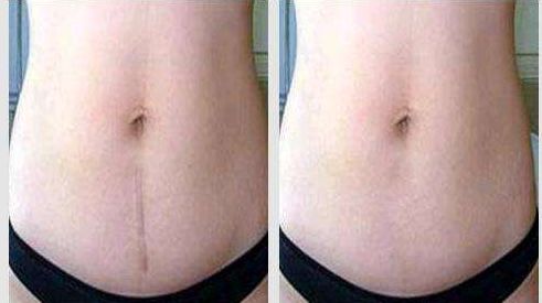 深圳很受推崇的雙眼皮修復(fù)醫(yī)生榜單發(fā)布！探尋盡善盡美之道