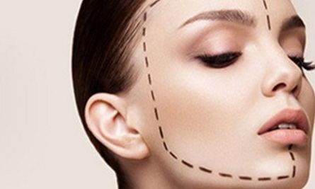 薛紅宇雙眼皮整形，獨特技術(shù)展示令人驚嘆