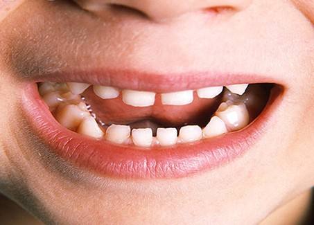 整形世界中，張笑天下頜角整形大概需要多少費用？醫(yī)院技術(shù)是如何保障的？