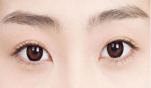 2023年廣州整形醫(yī)院首推雙眼皮修復，重磅名單揭曉！