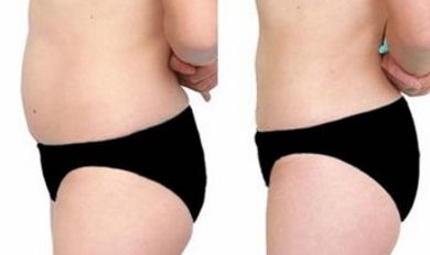 沈陽(yáng)醫(yī)大一院醫(yī)美，尋覓技術(shù)高超的大夫，暢談假體隆鼻案例！