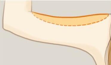 舟山市艾美醫(yī)學美容：楊誠、胡招兵醫(yī)生技術值得信賴嗎？他們的價目表如何？