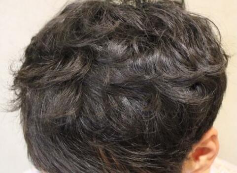 沈陽整形醫(yī)院哪家技術(shù)更先進(jìn)？有哪些正規(guī)醫(yī)美機(jī)構(gòu)？（附詳細(xì)價(jià)目表）