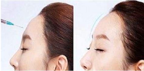 武漢雙眼皮最受歡迎的整形醫(yī)院排行榜前六！亞韓、中翰居前列為參考，看看哪家最贊！