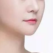 重磅推薦！全國(guó)頂級(jí)雙眼皮修復(fù)專(zhuān)家榜單揭曉，這四位醫(yī)師備受贊譽(yù)