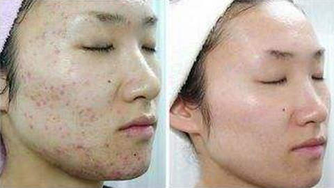 蘇州人民醫(yī)院整形科割眼袋靠譜嗎？專家資料簡(jiǎn)介，網(wǎng)友評(píng)價(jià)如何？