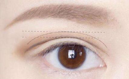 華中科技大學(xué)同濟(jì)醫(yī)學(xué)院附屬同濟(jì)醫(yī)院整形美容科：醫(yī)生技術(shù)究竟有何獨(dú)特之處？會(huì)帶來(lái)哪些效果？