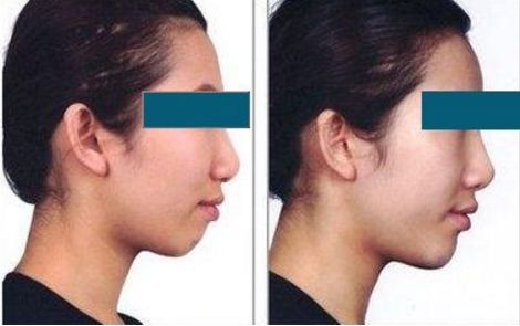 北京頂尖的整容專家排名揭曉！私人醫(yī)生榜單隆重公布