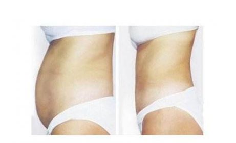 南京哪家整形醫(yī)院口碑比較好？推薦五家備受歡迎的醫(yī)院，了解詳情請點擊！