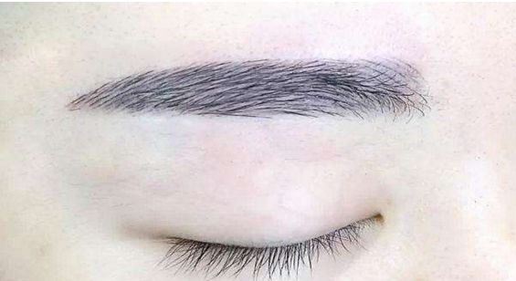 蘇州哪家醫(yī)院的拉皮除皺手術(shù)效果比較好？排名前五強(qiáng)公布