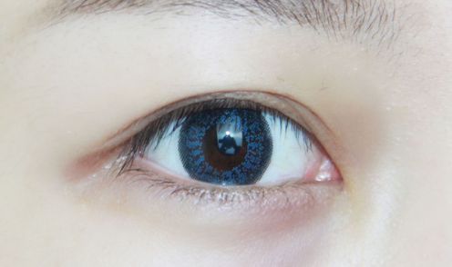 哈爾濱超龍整形醫(yī)院：雙眼皮術(shù)如何？專家給出全新醫(yī)學(xué)解決方案