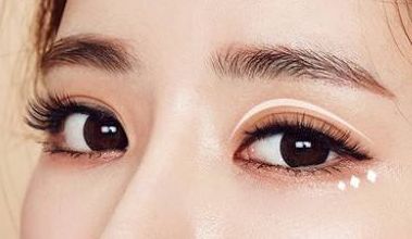 名師團(tuán)隊(duì)加持，葉飛輪打造雙眼皮，成就有形雙眼美！