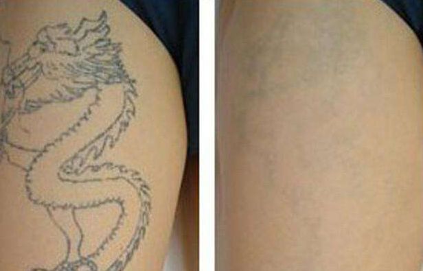 北京燒傷整形醫(yī)院排行榜：八大處、北醫(yī)三院齊名登榜