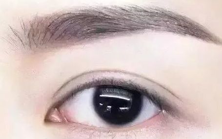 全國(guó)哪位專家值得信賴修復(fù)雙眼皮手術(shù)？頂級(jí)醫(yī)生排行榜首推名單揭曉