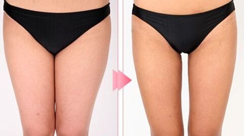 哈爾濱市十大雙眼皮整形醫(yī)生，絕對(duì)可信賴(lài)！