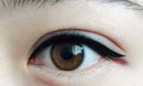 南京隆鼻術(shù)中高手脫穎而出！三位醫(yī)生實(shí)力強(qiáng)勁！