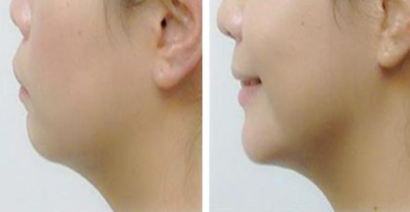 南京五家美容醫(yī)院，優(yōu)秀的整形實(shí)力與醫(yī)療專家分析