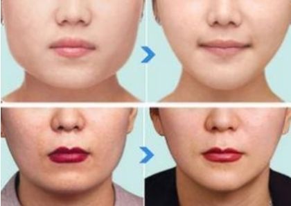 北京有哪些值得推薦的鼻整形醫(yī)生？年度五大鼻整形專家揭秘