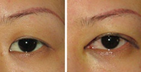 2023年北京專業(yè)處拉皮手術(shù)醫(yī)生推薦