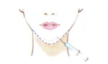 深度解析北京市五家翹首以望的頂級(jí)眼部整形醫(yī)院