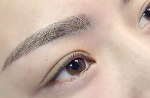 眼袋手術(shù)費(fèi)用及醫(yī)生評(píng)價(jià)與項(xiàng)目分析？