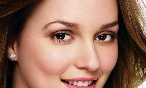 專業(yè)醫(yī)生為您解讀：上海美賦張宇醫(yī)生，最新雙眼皮術(shù)操作案例盤點