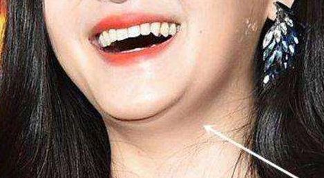 恩施州中心醫(yī)院整形外科療效如何？專家解析+服務(wù)費用披露