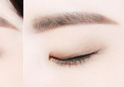 廣州哪家醫(yī)院的雙眼皮手術(shù)好？權(quán)威榜單熱門揭曉！