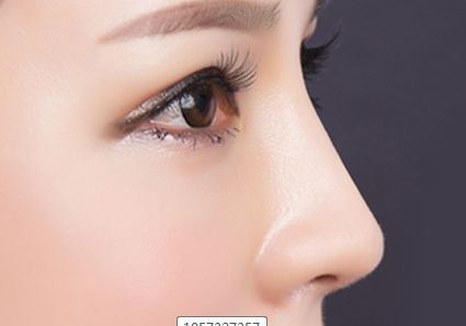 李天石磨骨費(fèi)用公示與患者見證，現(xiàn)網(wǎng)友分享醫(yī)師簡介！