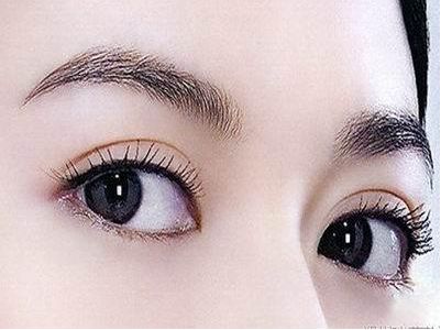 范海燕雙眼皮手術效果如何？點進來體驗真實案例，見證醫(yī)生妙手重塑！