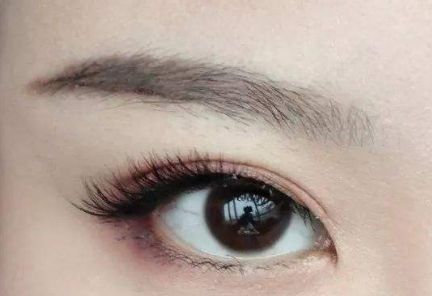 大連王琳雙眼皮的完美實踐，80天親身體驗揭秘