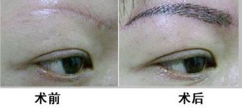 廣州哪家醫(yī)院靠譜？私立醫(yī)美口碑排行榜來襲！