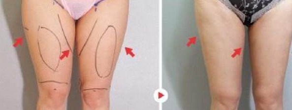 國內(nèi)頂級隆胸醫(yī)生名人榜，權(quán)威大咖云集