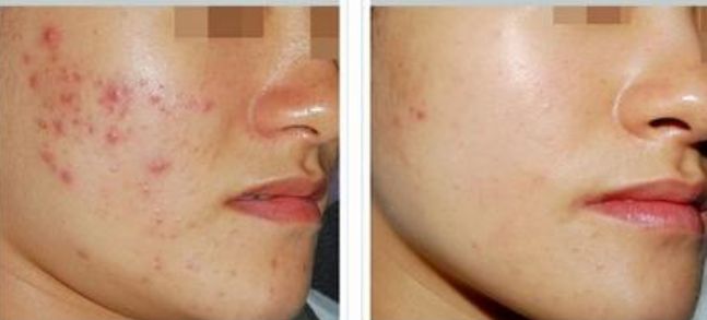 沈陽盛京醫(yī)院唇腭裂專家團(tuán)隊(duì)及最新收費(fèi)明細(xì)