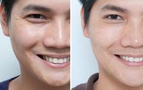 選擇正規(guī)的西安整形醫(yī)院，這些排行名單都推薦！