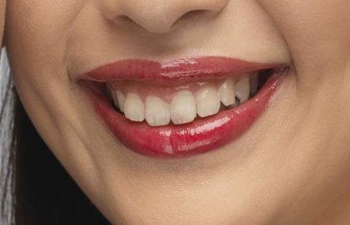 2023年北京近視手術(shù)高手引領(lǐng)潮流，瞿長斌、林順潮、熊瑛等五位專家資料公開！