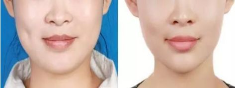 武漢市優(yōu)質(zhì)近視手術(shù)醫(yī)院排名榜單精選！信賴度極高的醫(yī)療機(jī)構(gòu)！