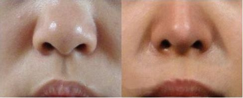 上海哪家醫(yī)院進行拉皮手術的技術和聲譽最出色？