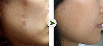 全國(guó)植發(fā)醫(yī)院排名揭曉！最值得信賴的連鎖機(jī)構(gòu)名單公開