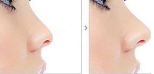 2023年，揭示重慶整形醫(yī)院的實力和口碑的全新文章！