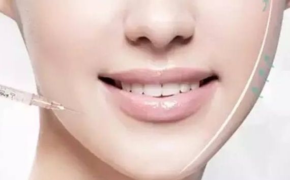 上海九院王健的雙眼皮手術(shù)效果如何？醫(yī)生經(jīng)驗與成功案例分享